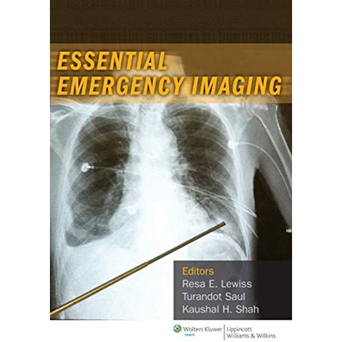 Essential Emergency Imaging (Pb) 