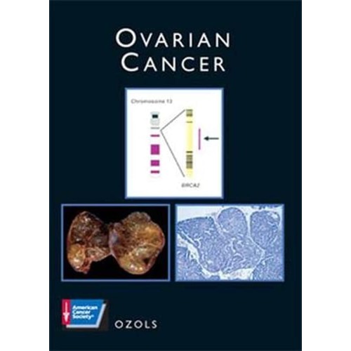 Ovarian Cancer: A Volume In The American Canc...