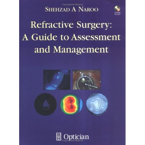 Refractive Surgery A Guide To Assessment Ane ...