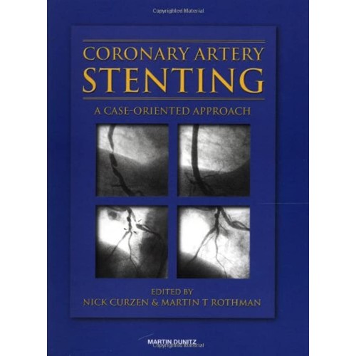 Atlas Of Coronary Stenting 