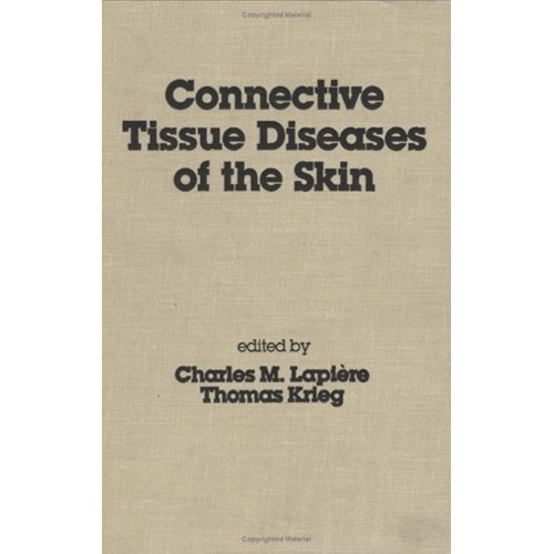 Connective Tissue Diseases Of The Skin 