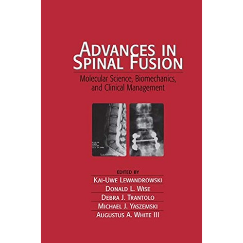 Advances In Spinal Fusion (Hb 2003)