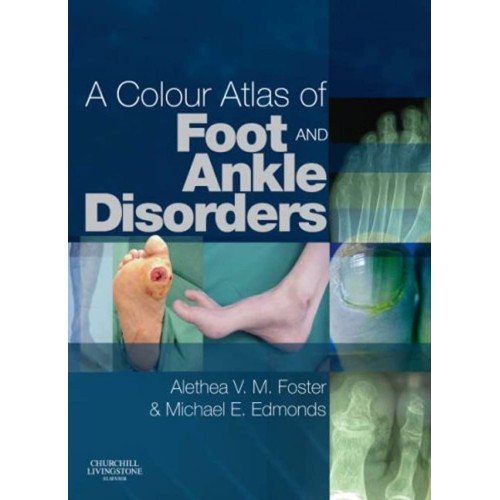 A Colour Atlas Of Foot And Ankle Disorders 