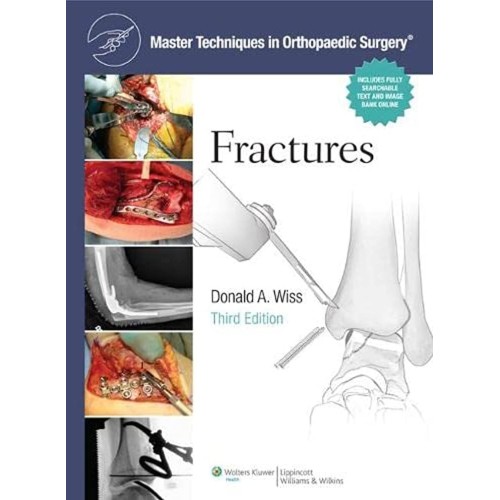 Master Techniques In Orthopaedic Surgery Frac...