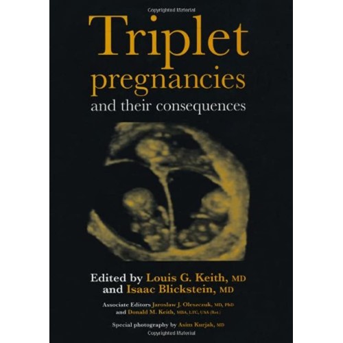 Triplet Pregnancies And Their Consequences 