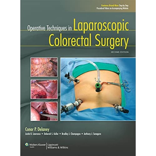 Operative Techniques In Laparoscopic Colorect...