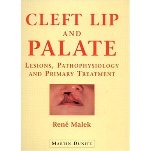 Cleft Lip & Palate : Lesions, Pathophysiology...