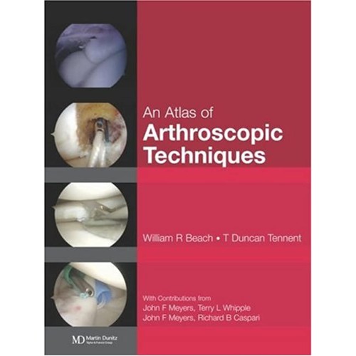 An Atlas Of Arthroscopic Techniques 