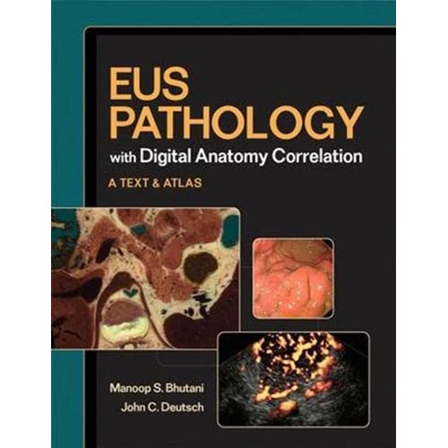 Eus Pathology With Digital Anatomy Correlatio...