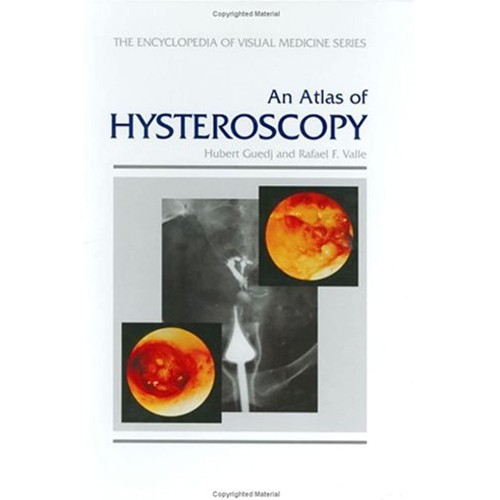 An Atlas Of Hysteroscopy: A Guide To Diagnosi...