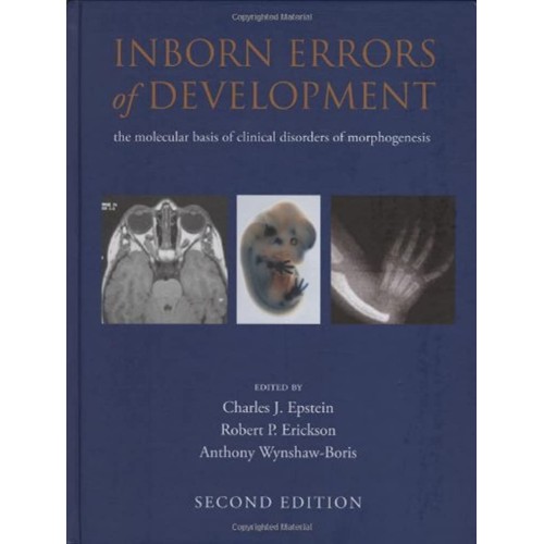 Inborn Errors Of Development 2Ed 