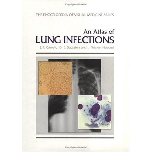 An Atlas Of Lung Infections (The Encyclopedia...