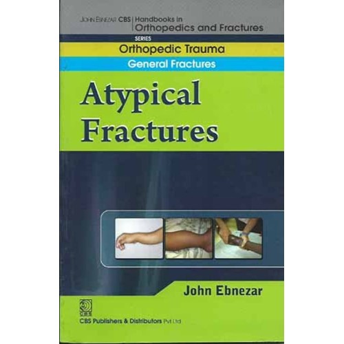 A Typical Fractures (Handbook In Orthopedics ...