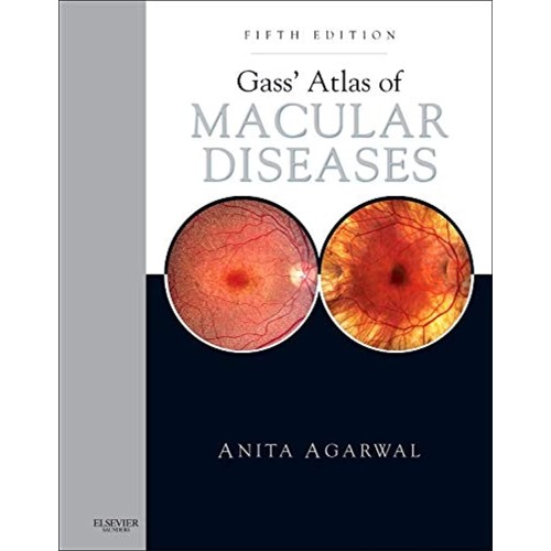 Gass Atlas Of Macular Diseases 2 Vol Set 5Ed ...