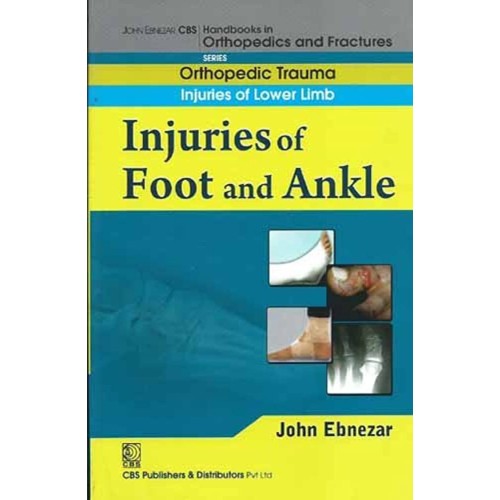 Injuries Of Foot And Ankle (Handbook In Ortho...