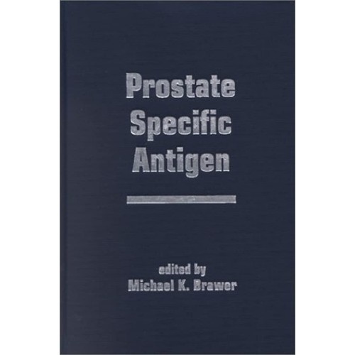 Prostate Specific Antigen 