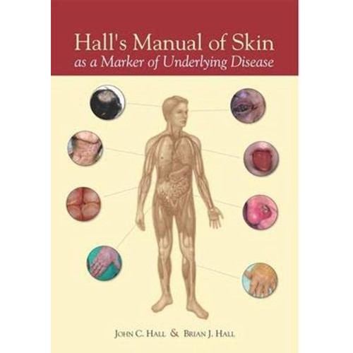 Hall’S Manual Of Skin As A Marker Of Underl...