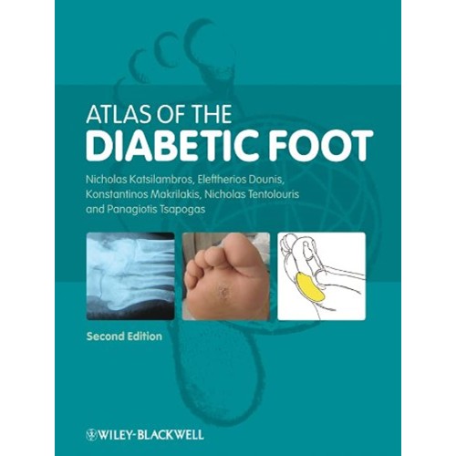 Atlas Of The Diabetic Foot 2Ed (Hb 2010) 