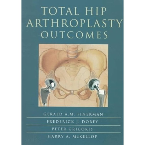 Total Hip Arthroplasty Outcomes (Pb 1998)