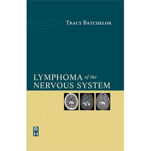 Lymphoma Of The Nervous System (Hb 2004)