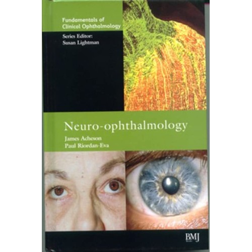 Neuro-Ophthalmology 