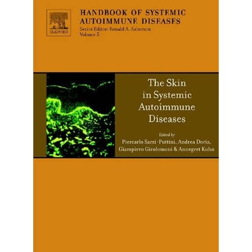 Hand Book Of Systemic Autoimmune Diseases The...