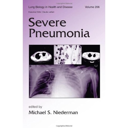 Severe Pneumonia Vol 206 