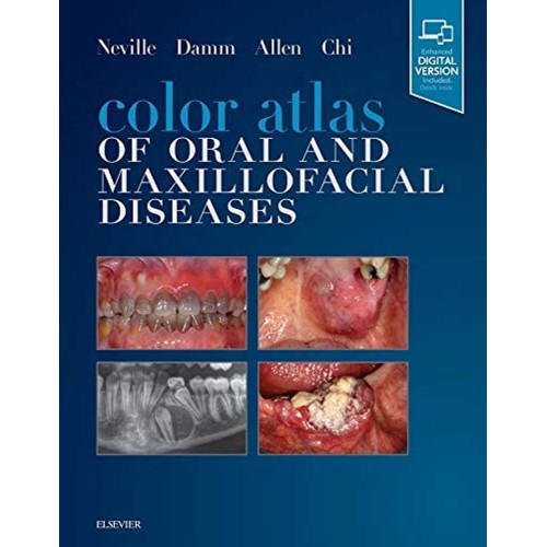 Color Atlas Of Oral And Maxillofacial Disease...