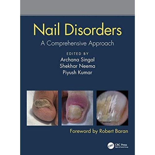 Nail Disorders A Comprehensive Approach (Hb 2...