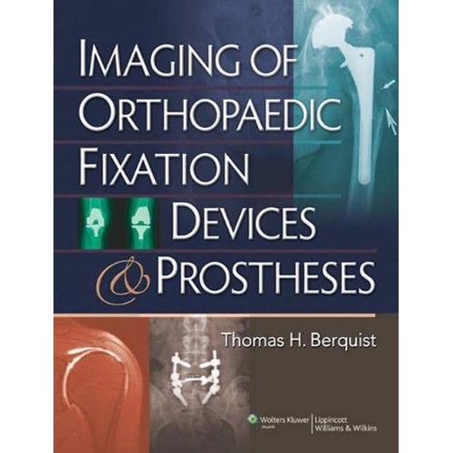 Imaging Of Orthopaedic Fixation Devices And P...