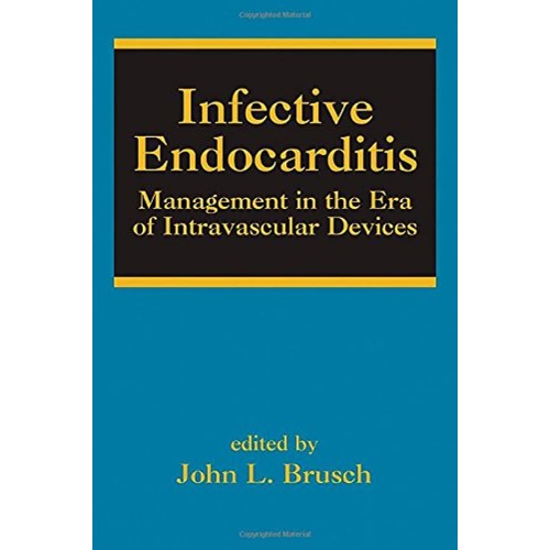 Infective Endocarditis Management In The Era ...