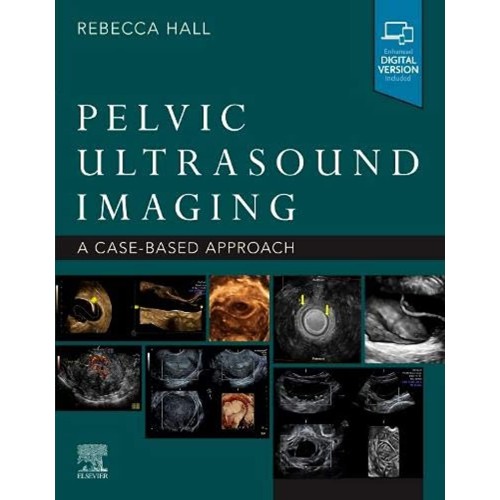 Pelvic Ultrasound Imaging A Case Based Approa...