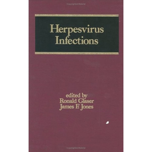 Herpesvirus Infections (Infectious Disease An...