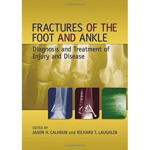 Fractures Of The Foot And Ankle 