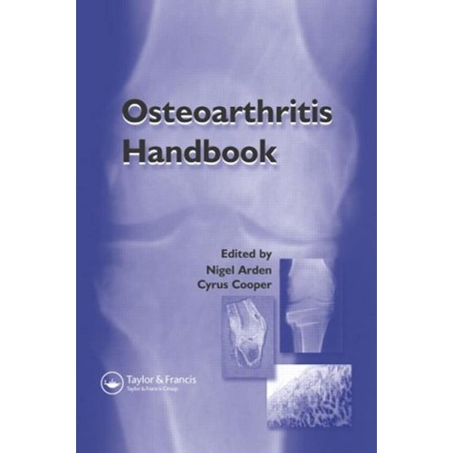 Osteoarthritis Handbook 