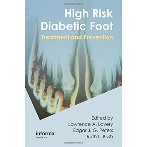 High Risk Diabetic Foot Treatment And Prevent...