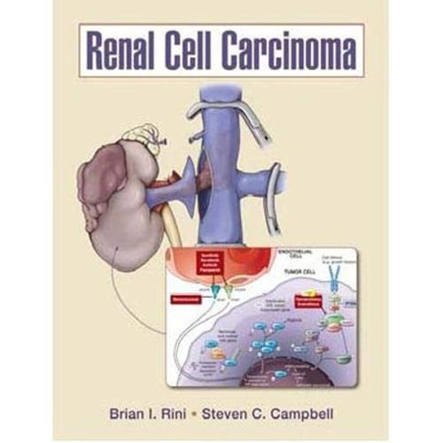 Renal Cell Carcinoma (Hb 2009)