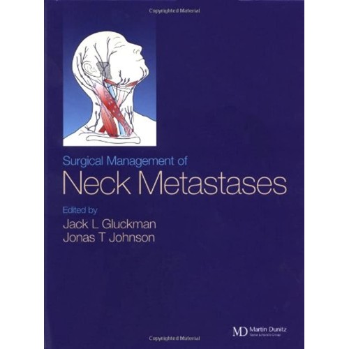 Surgical Management Of Neck Metastases 