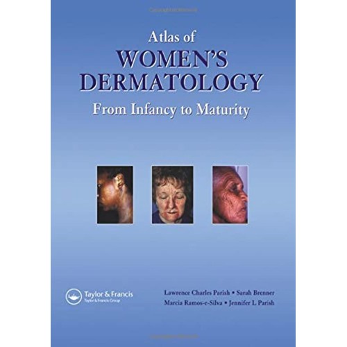 Atlas Of Women'S Dermatology From Infancy To ...