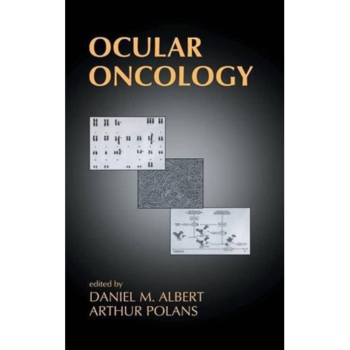 Ocular Oncology 