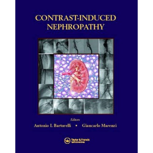 Contrast-Induced Nephropathy 