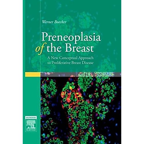 Preneoplasia Of The Breast A New Conceptual A...