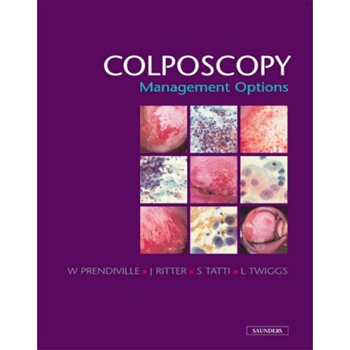 Colposcopy Management Options (Hb 2003)