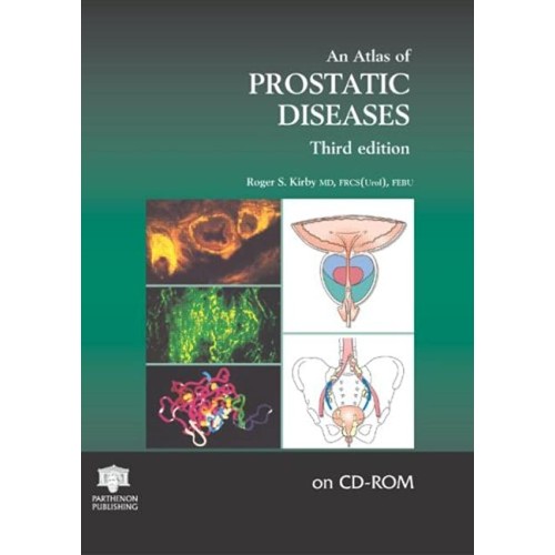 An Atlas Of Prostatic Diseases 