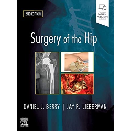 Surgery Of The Hip With Access Code 2Ed (Hb 2...