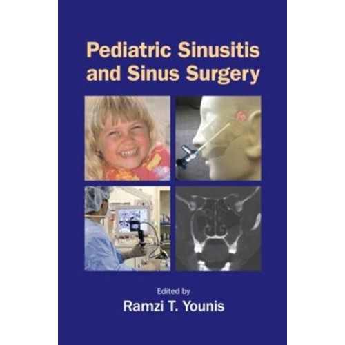 Pediatric Sinusitis And Sinus Surgery (Hb 200...