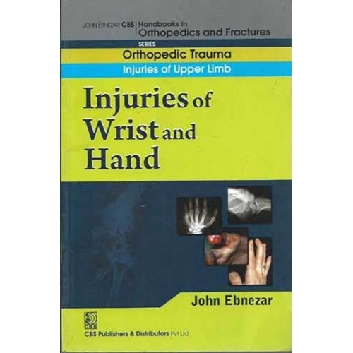 Injuries Of Wrist And Hand (Handbook In Ortho...