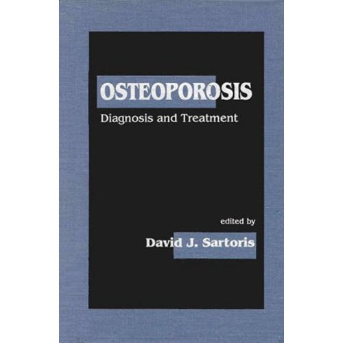 Osteoporosis : Diagnosis And Treatment 