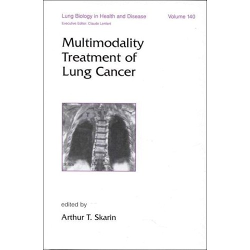 Multimodality Treatment Of Lung Cancer, Vol-1...