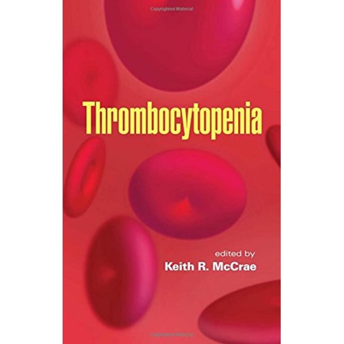 Thrombocytopenia (Basic And Clinical Oncology...